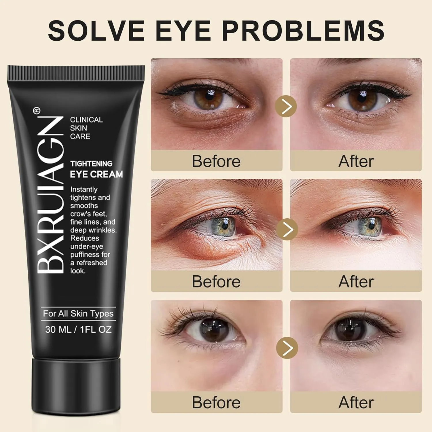Instant Eye Tightener – Under Eye Tightening Cream for Puffiness & Wrinkles, Anti-Aging Eyes Serum with Hyaluronic Acid & Peptides, Dark Circle Treatment, EYE Bag Remover Treatment (1)